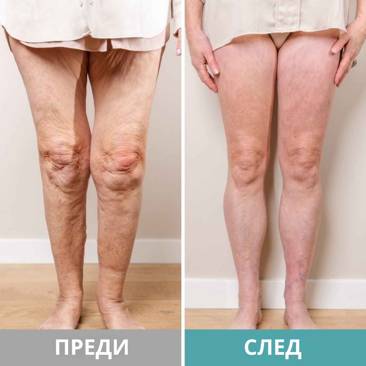 Масажор за крака IKEROS™ Борите ли се с болки в краката, подуване, схванатост или изтръпване?