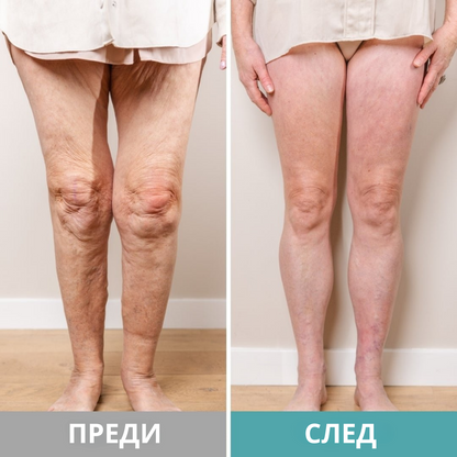 Масажор за крака IKEROS™ Борите ли се с болки в краката, подуване, схванатост или изтръпване?